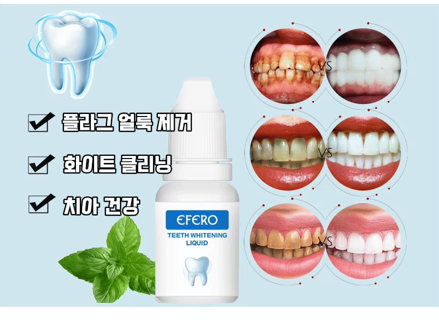 치아미백제